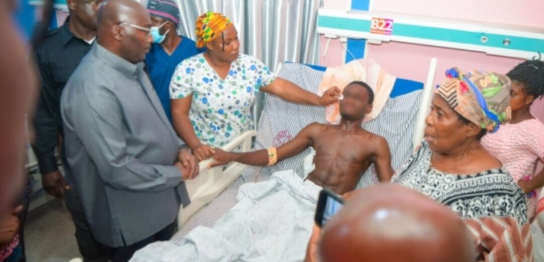 Dr. Bawumia Visits Injured KNUST Student, Donates GH¢50,000