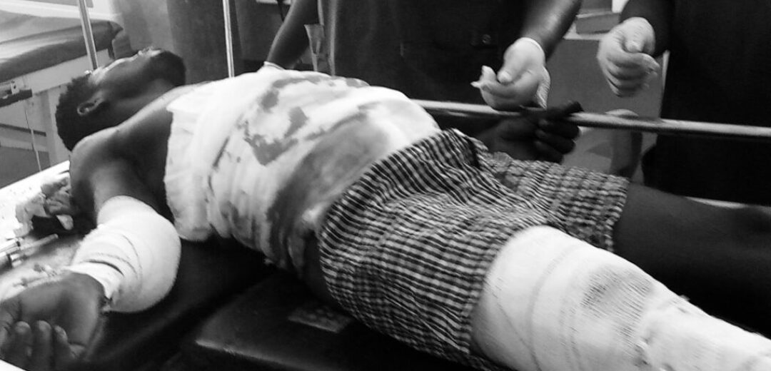 E/R:Vulcanizer Machine Explodes in Mankessim, Man Left Fighting for Life.
