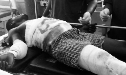 E/R:Vulcanizer Machine Explodes in Mankessim, Man Left Fighting for Life.