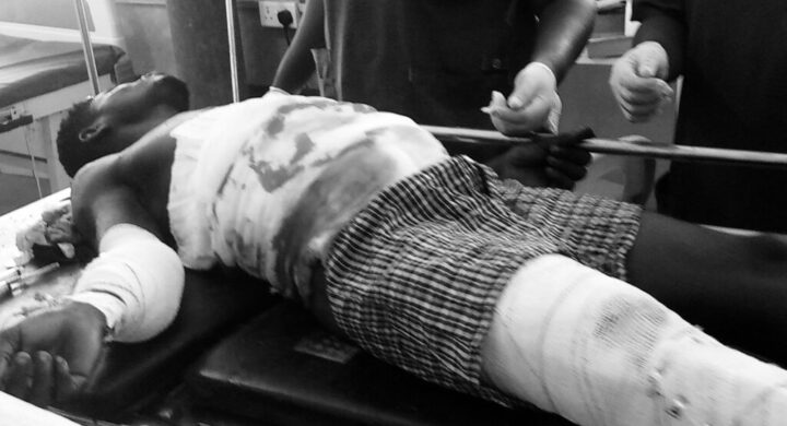 E/R:Vulcanizer Machine Explodes in Mankessim, Man Left Fighting for Life.