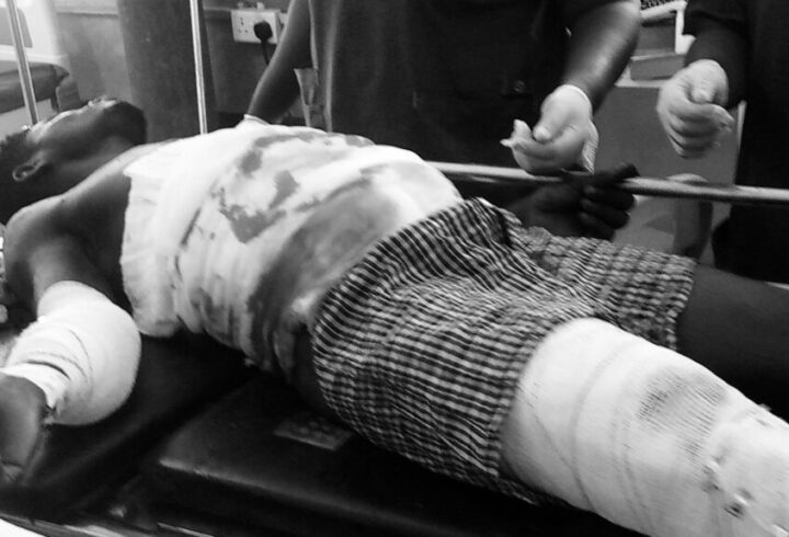 Vulcanizer Machine Explodes in Mankessim, Man Left Fighting for Life.