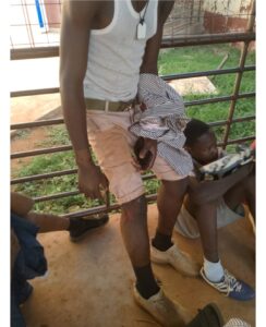 Eight BECE Candidates Injured in Fatal Accident