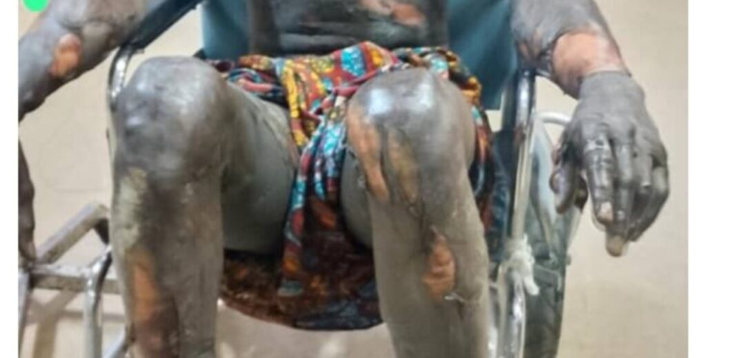 Wa East: Galamsey Operator Alleges Brutal Military Attack in Wa East