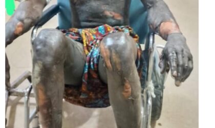 Wa East: Galamsey Operator Alleges Brutal Military Attack in Wa East