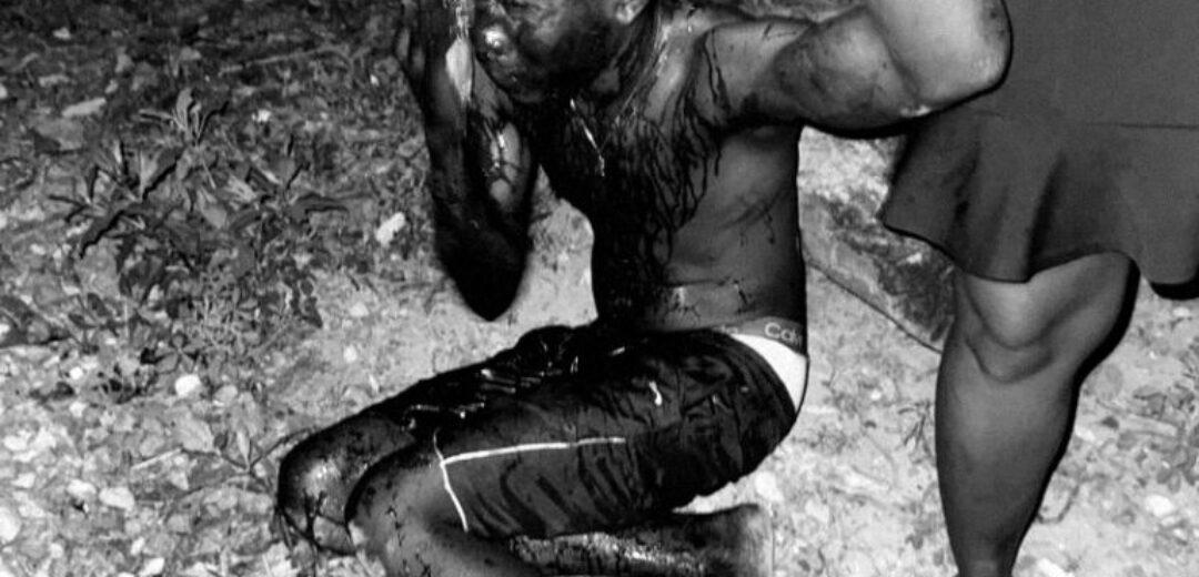 E/R: YOUNGMAN ESCAPES DEATH AFTER BROTHER IN-LAW BUTCHERES HIM AT AFOSU
