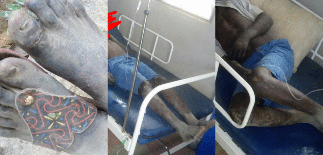 “Abofour Health Center’s Psychiatric Unit Leads the Way in Mental Health Support