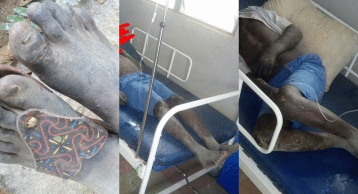 “Abofour Health Center’s Psychiatric Unit Leads the Way in Mental Health Support