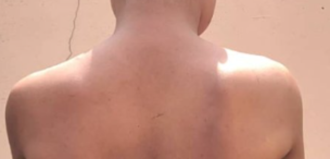 Resilience and Hope: SCA Ghana Supports Survivors of Human Trafficking