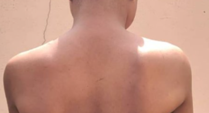 Resilience and Hope: SCA Ghana Supports Survivors of Human Trafficking