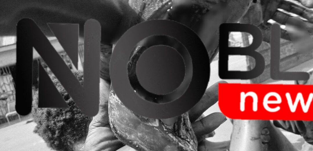 Machete Fight Erupts in Bonkame, Leaves Several Injured
