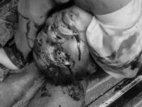 E/R: Four Dead, Several Injured In Collision At Anyinasin Junction On Accra-Kumasi Highway